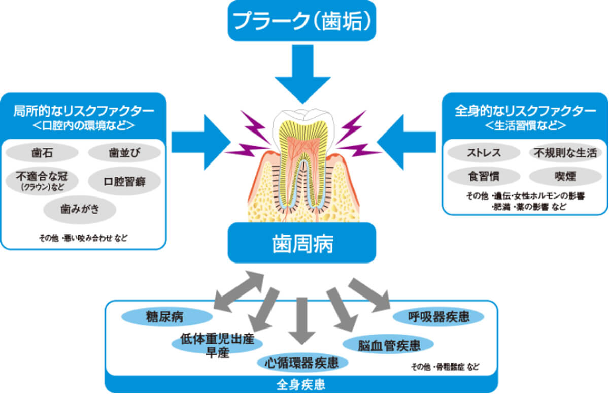 歯周病の原因